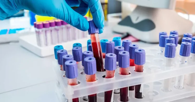 Ümumi qan analizinin xərçəngi aşkar edə biləcəyi fikri yanlışdır?