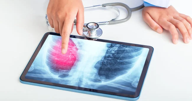 “Ən qorxulu tərəfi odur ki, asbestin zərəri dərhal özünü göstərmir illərlə bədəndə yığıldıqdan sonra ortaya çıxır”