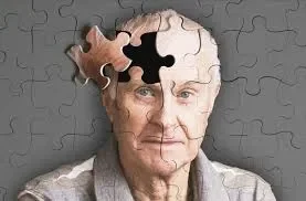 Alzheimer xəstəliyi REM yuxusunun yavaş başlaması ilə müşayiət OLUNUR