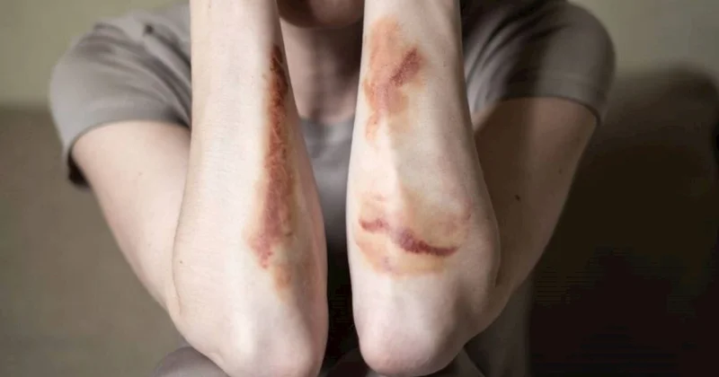 Yasamalda qadın döyüldü MƏHKƏMƏ