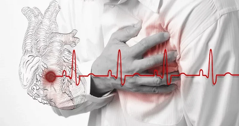 Covid 19 dan sonra infarkt cavanlaşdı