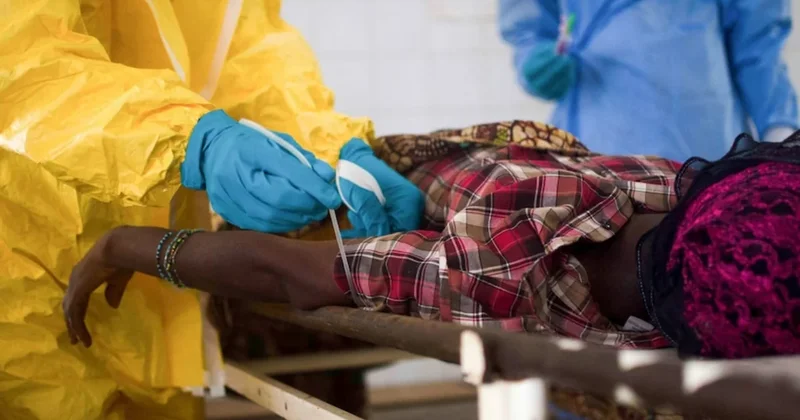 Afrikada vəba epidemiyası: 14 ölkəyə yayıldı