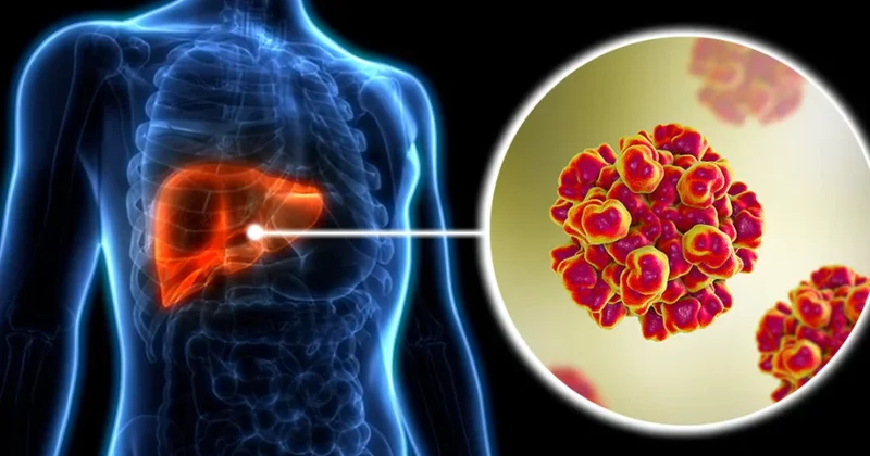 Hepatit E virusunu BƏSLƏYƏN ORQAN Qaraciyərdə olduğu kimi...