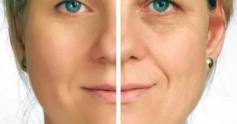 Qırışlar nədən yaranır? Alimlər AÇIQLADI