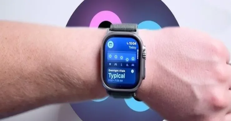 “Apple Watch” almağı planlaşdıranlara pis xəbər Bu şeylər olmayacaq