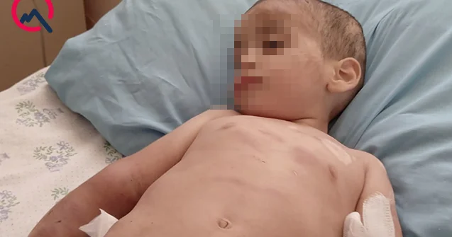 Ağdamda iki yaşlı uşaq döyülüb Atası saxlanıldı