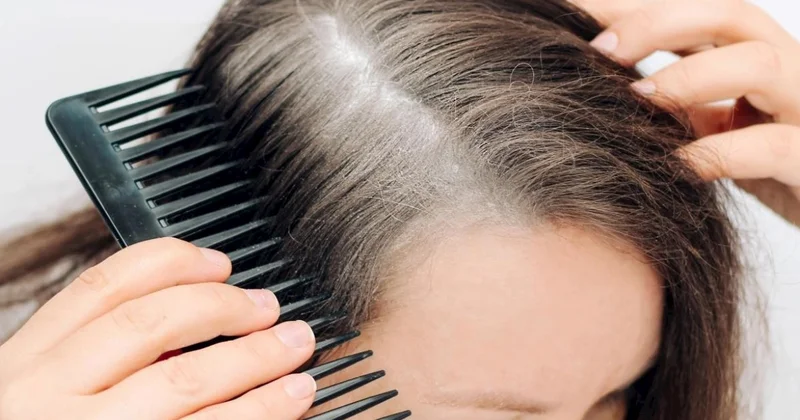 Ağ saçları qalıcı şəkildə necə maskalamaq olar? Stilistdən 3 seçim