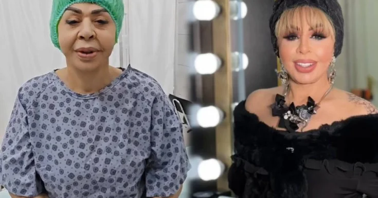 Ruhəngiz Allahverdiyeva plastik əməliyyat etdirdi