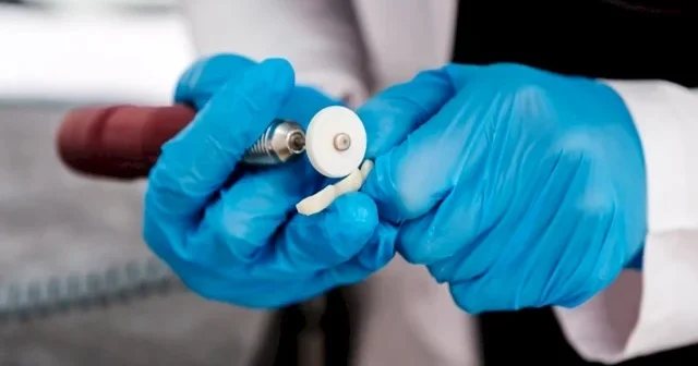 Həkim: İmplant sığorta paketinə daxil deyil