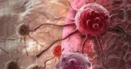 Bu xəstəliklərin tibbi sığorta paketinə daxil edilməsi sosial zərurətdir İqtisadçı