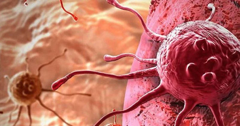 Xərçəng Azərbaycanda əl qolunu açır: hansı tədbirlər görülməlidir?