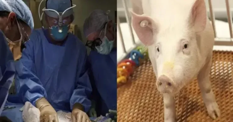 60 gündən çoxdur donuz böyrəyi ilə yaşayır