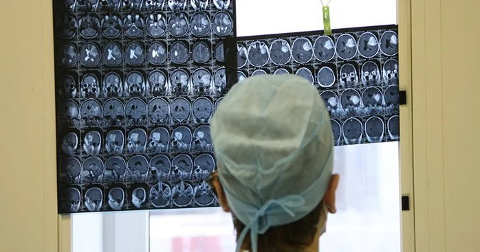 Kişi beyni qadın beynindən daha tez qocalır ARAŞDIRMA