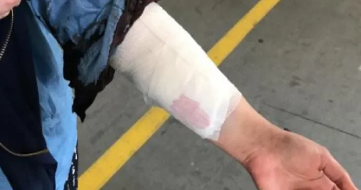 Salyanda kişi qısqanc sevgilisini döyüb dişlədi