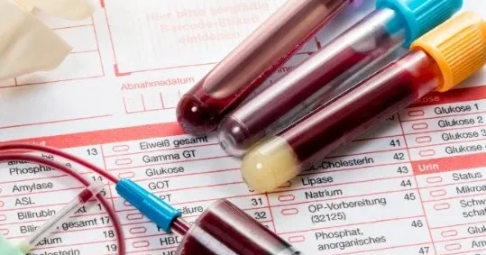 Mütəxəssis sağlamlıq üçün vacib olan illik analizləri SADALADI