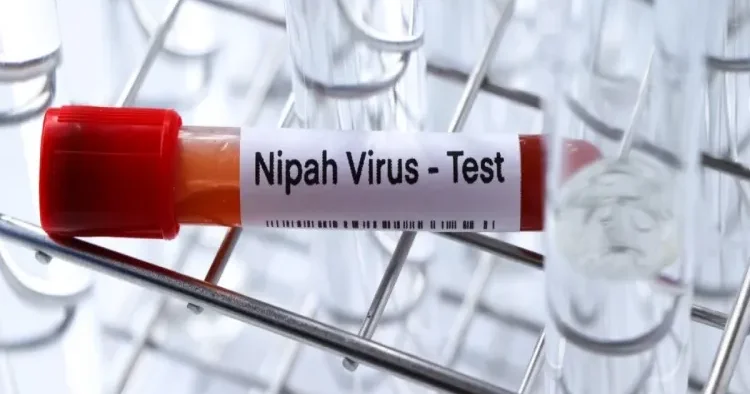 Gürcüstanda Nipah virusu aşkarlanmayıb