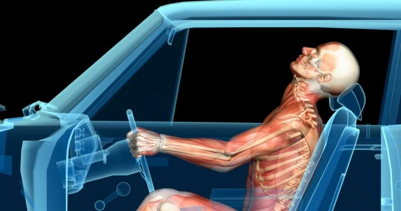 Avtomobil qəzalarında ən çox boyun və baş nahiyəsi zədələnir