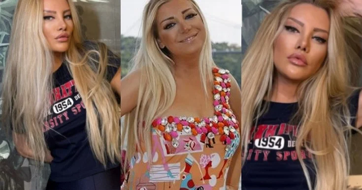 Gülşah Saraçoğlu 9 saatlıq estetik əməliyyatdan sonra Fotolar