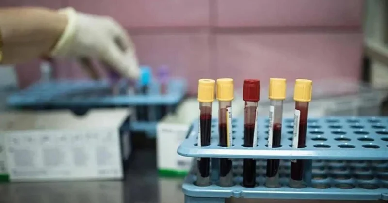 Xərçəngin bu növü Y nəslinin yeni kabusuna çevrilib