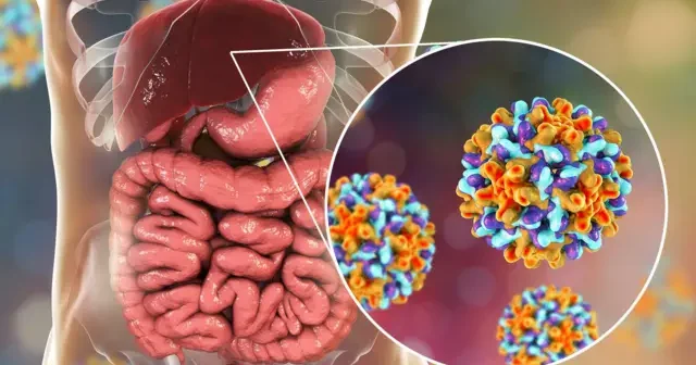 Dünyada 304 milyon insan hepatit B və ya C virusu ilə yaşayır