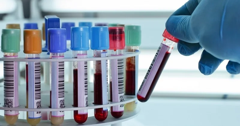 Azərbaycanda ötən il 634 nəfərdə hepatit aşkarlanıb