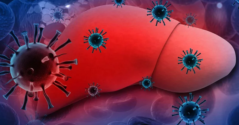 Azərbaycanda hepatit xəstələrinin sayı AÇIQLANDI