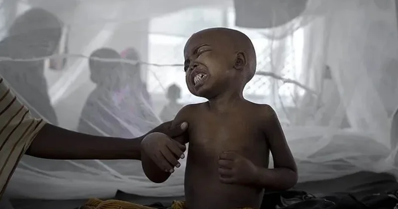 Nigeriyada vəba epidemiyası: 14 nəfər öldü