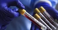 Uqandada Ebola qızdırması alovlanması başa çatıb