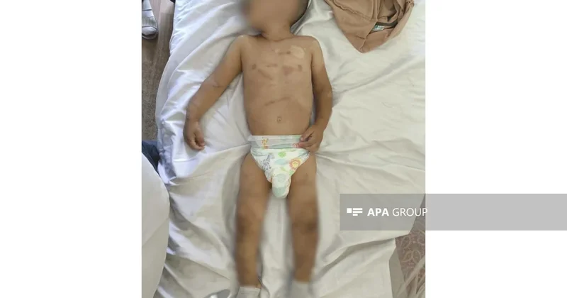 Ağdamda daha əvvəl də işgəncə görən körpənin anasına verilməsinin səbəbi açıqlanıb