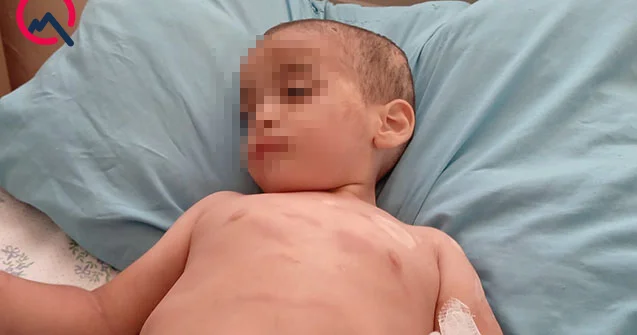 Uşağı daha əvvəl də xalası döyübmüş Rəsmi açıqlama