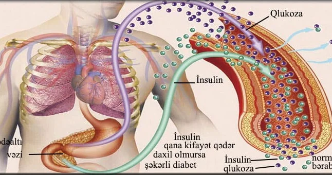 Bu üsulla diabetdən qoruna bilərsiniz