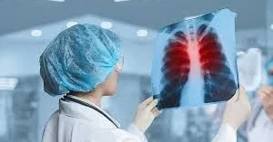 Son 20 ilin dəhşəti Vərəm qlobal miqyasda oyanır