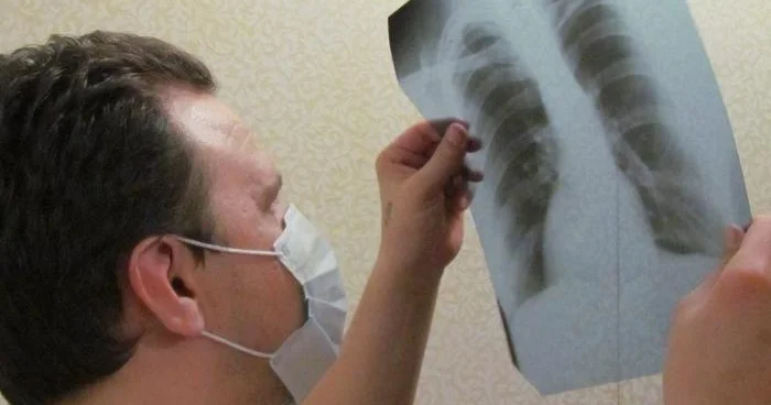 Son illərdə gənclər arasında bu xəstəlik artıb Səbəbi bəlli oldu