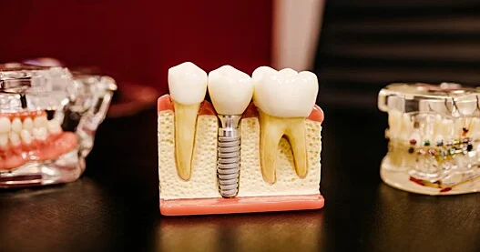 Niyə dişlər sümük hesab edilmir?