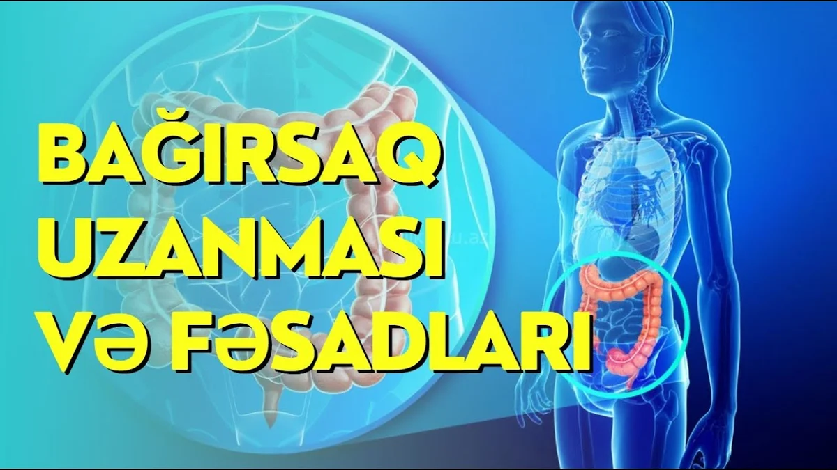 Bağırsaq uzanması və fəsadları həkim İlqar Alışov sualları cavablandırır