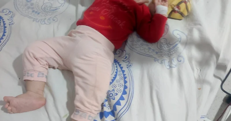 Bir yaşlı körpənin yaşaması üçün təcili əməliyyata ehtiyac var