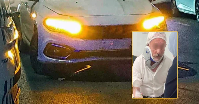 “Fiat” sürücüsü skuter sürən uşağı vurdu; ailəsi hücuma keçdi FOTO VİDEO