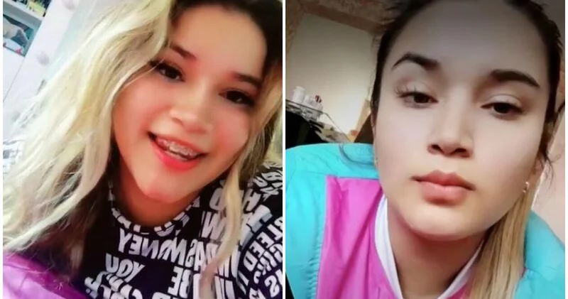 Estetik əməliyyat faciə ilə bitdi Toyuna günlər qalmışdı... FOTO