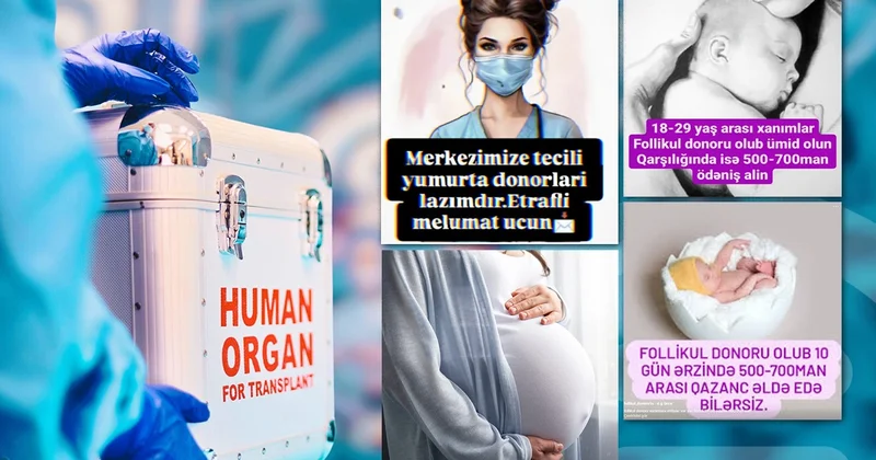 Azərbaycanda orqan satışı yenidən gündəmdə: Gələcəkdə bacı qardaş evliliyinə yol aça bilər