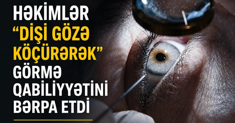 Tibbdə qeyri adi əməliyyat
