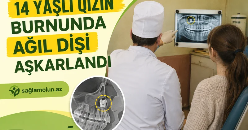 NADİR TİBBİ ANOMALİYA