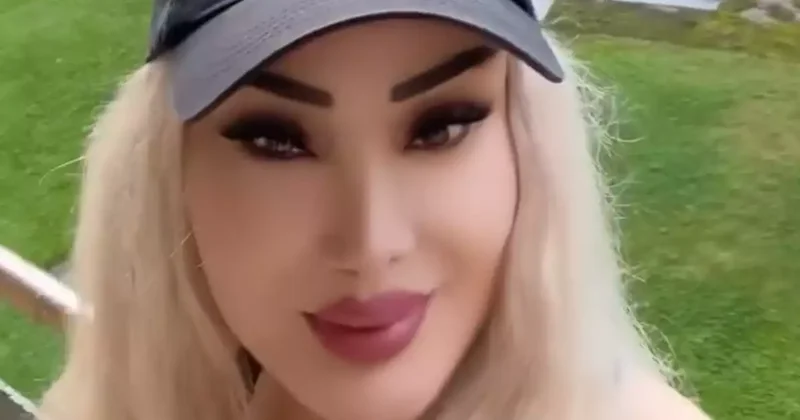 Məleykə Əsədova estetik etdirib?