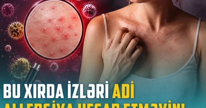 Qısa təmasla yoluxma riski: Ev heyvanınız infeksiya mənbəyinə çevrilə bilər