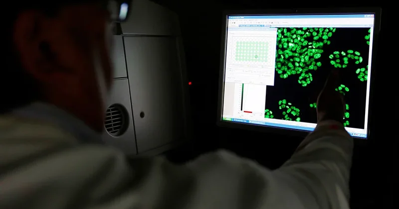 “Dünyada onkoloji ölüm halları 2050 ci ilə qədər kəskin artacaq“ Yeni araşdırma