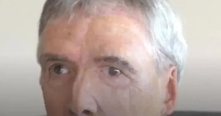 Britaniyalı kişi protezlə üzünü “geri qaytardı”