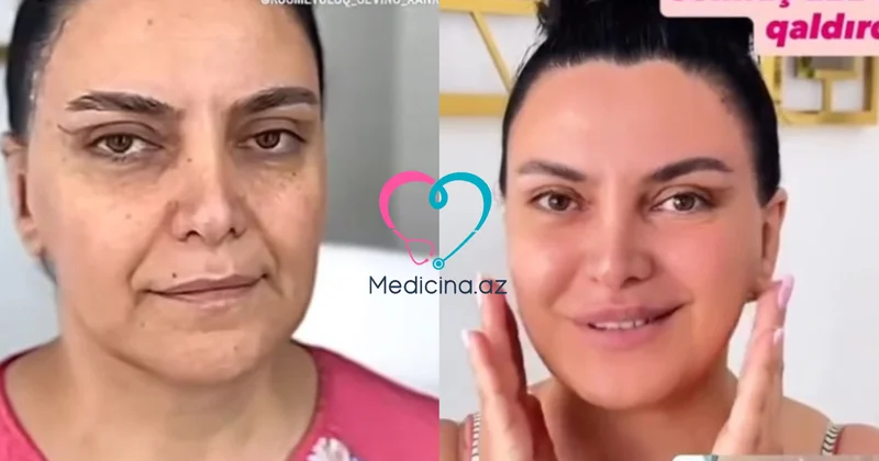 Bakıda qadının dəyişimi hamını şoka saldı VİDEO