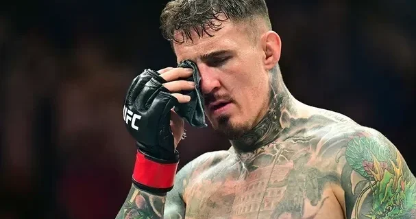 “Hər şey pisdir” Aspinallın atası Tomun gözü barədə