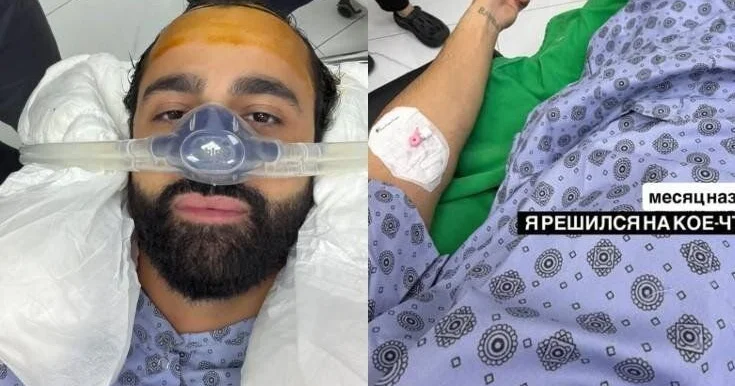 Hüseyn saç əkdirdi FOTO