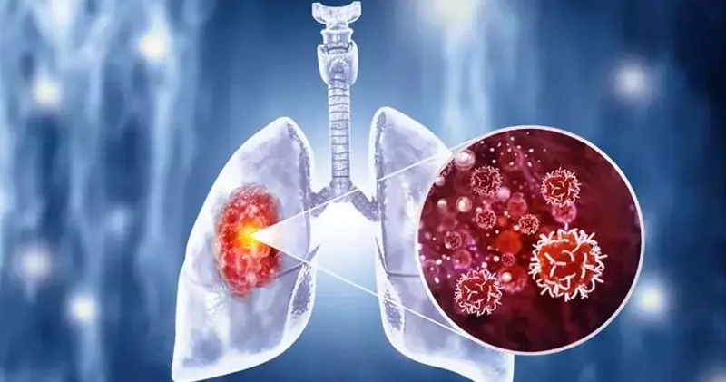 Dünyanın ən ölümcül yoluxucu xəstəliyi: Hər il bir milyon insan öldürür