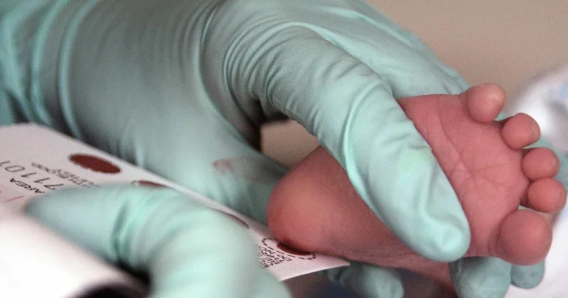 Yeni doğulan körpələrə daban testi edilir